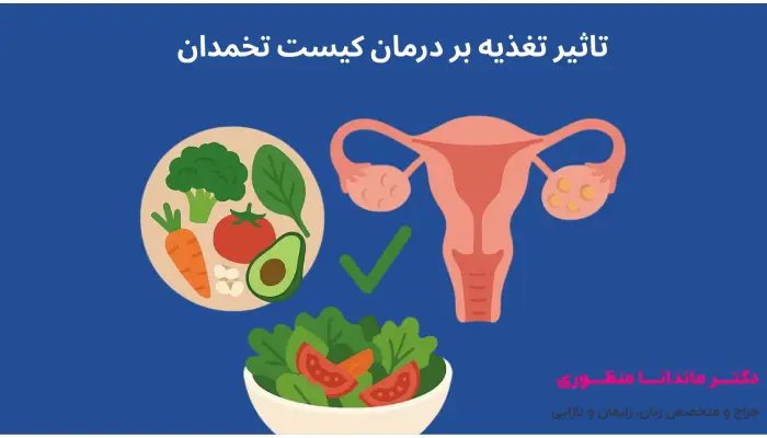 تاثیر تغذیه بر درمان کیست تخمدان