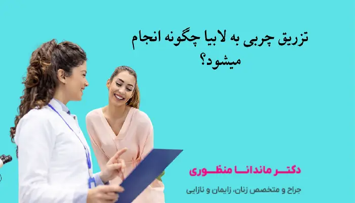 تزریق چربی به لابیا چگونه انجام میشود؟