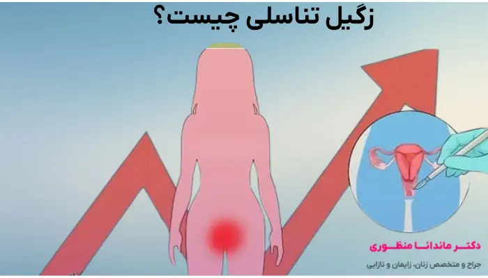 زگیل تناسلی چیست
