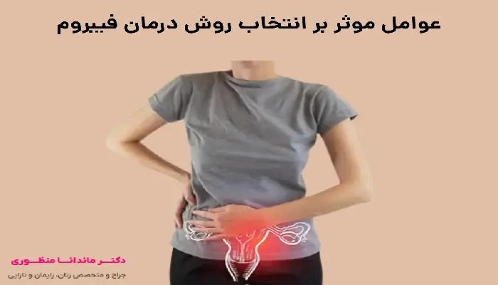 عوامل موثر بر انتخاب روش درمان فیبروم