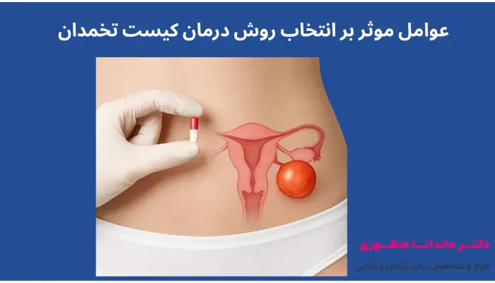 عوامل موثر بر انتخاب روش درمان کیست تخمدان
