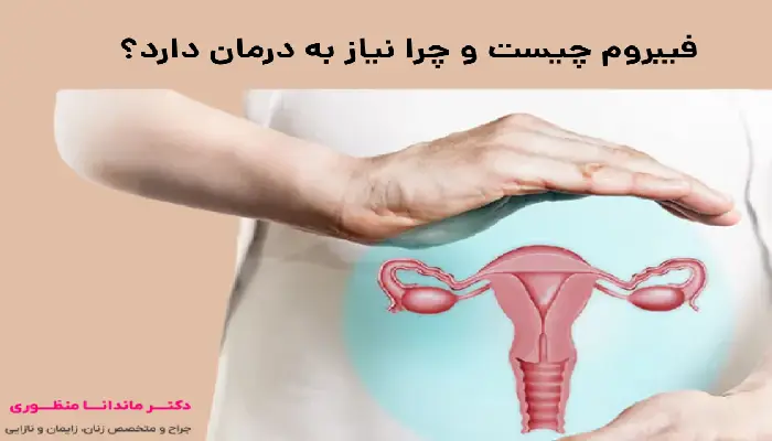 فیبروم چیست و چرا نیاز به درمان دارد؟