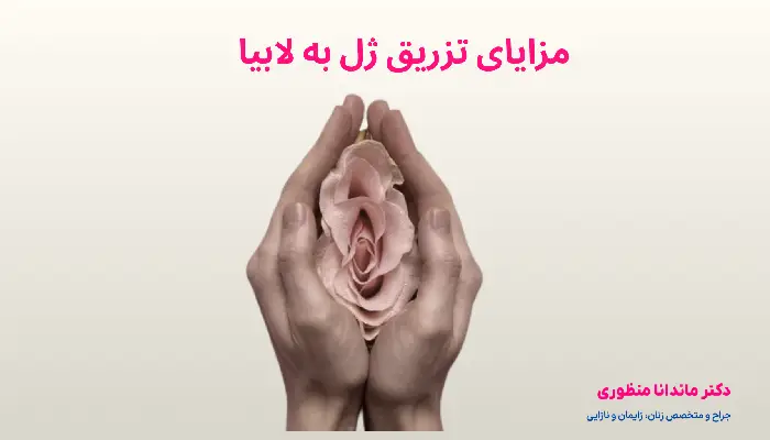 مزایای تزریق ژل به لابیا