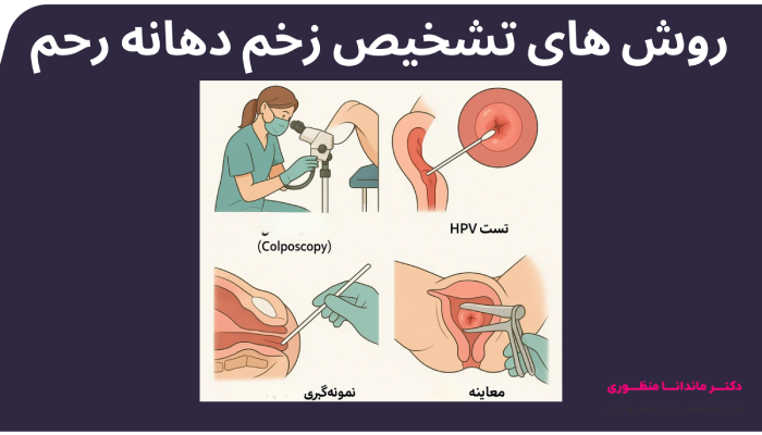 روش های تشخیص زخم دهانه رحم