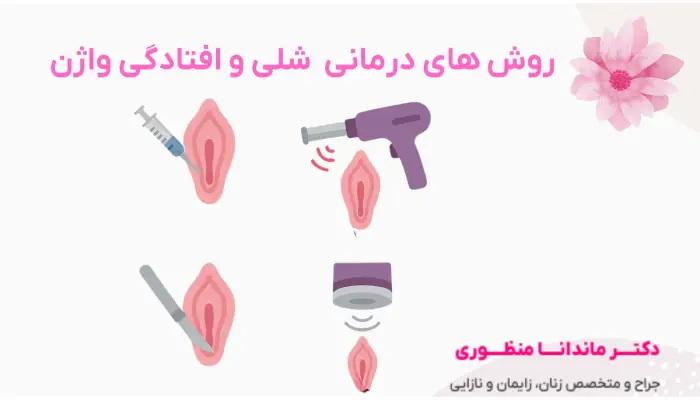 روش های درمانی شلی و افتادگی واژن