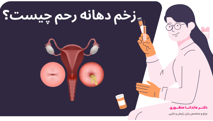 زخم دهانه رحم چیست؟