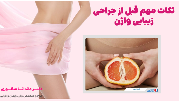 نکات مهم قبل از جراحی زیبایی واژن