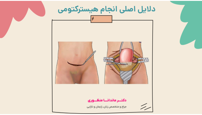 دلایل اصلی انجام هیسترکتومی