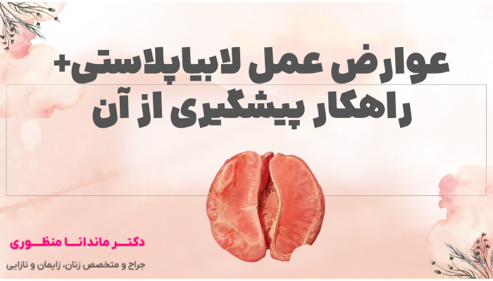 عوارض عمل لابیاپلاستی+ راهکار پیشگیری از آن