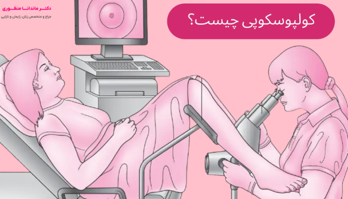 کولپوسکوپی چیست؟